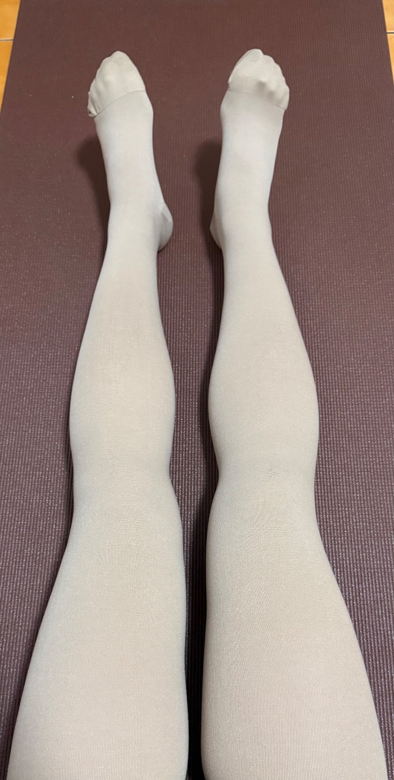 服務業 上班久站，水腫酸痛，並已出現蜘蛛網狀血管紋路